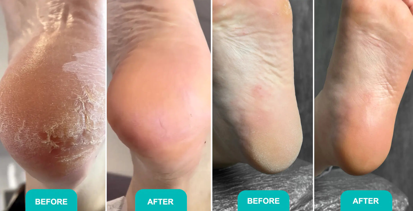 Shelly Schiuma ammorbidente Express per Pedicure Soft